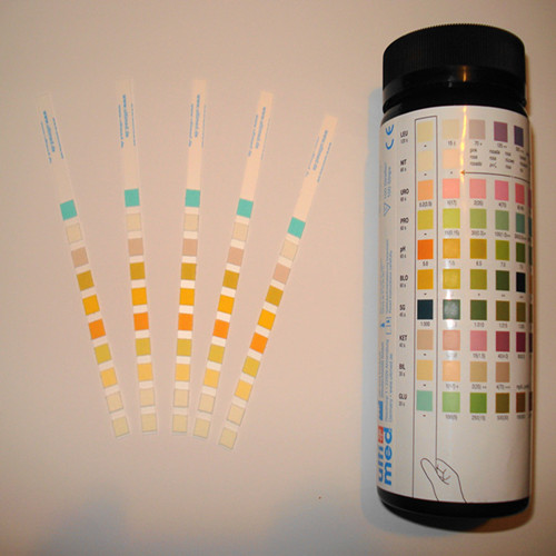 Urine Test Strip